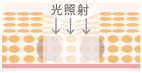 光照射