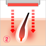 STEP2