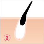 STEP3